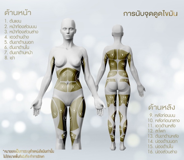 ดูดไขมัน