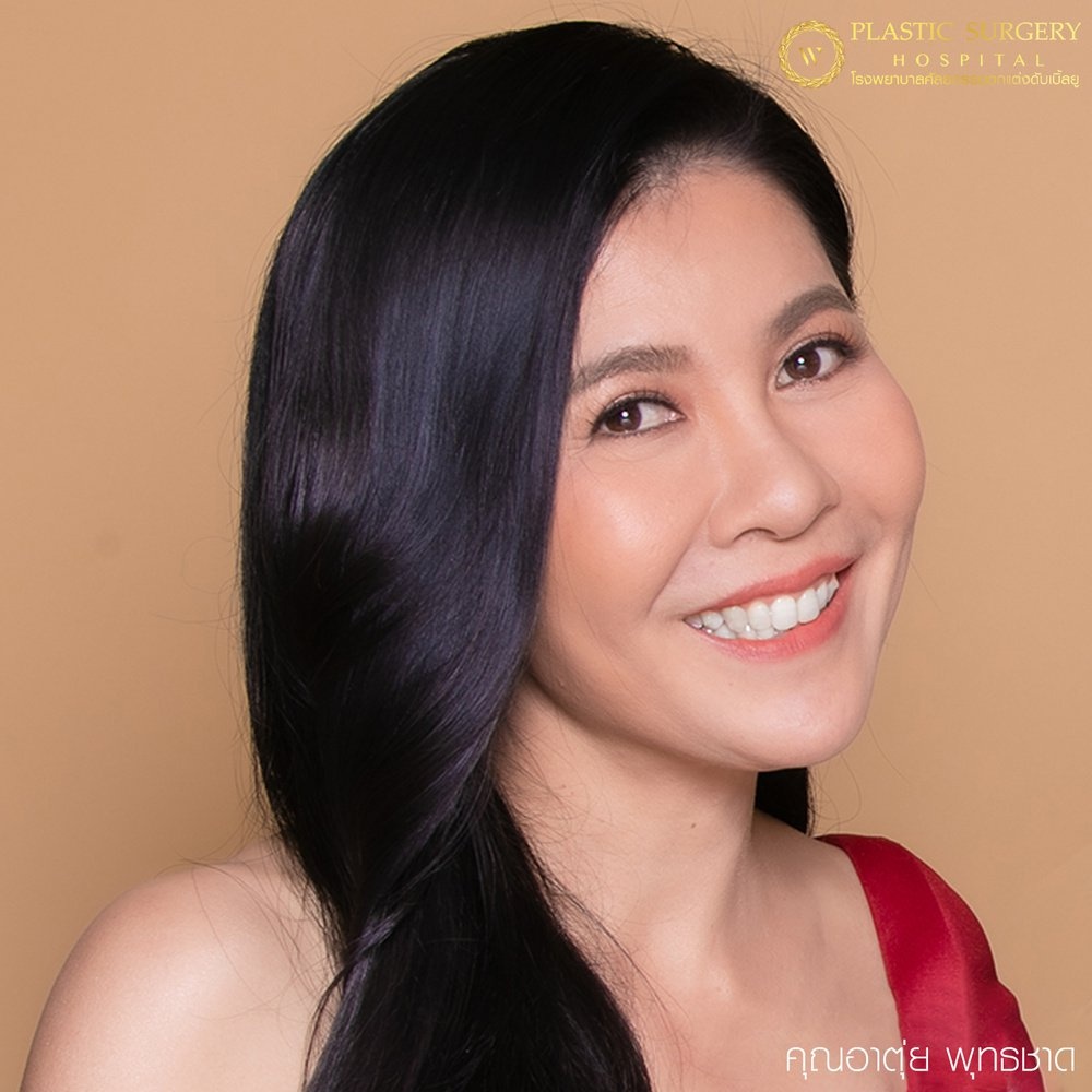 ศัลยกรรมแก้ไขปัญหาหนังตา