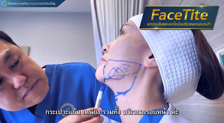 คุณปุ้ย facetite