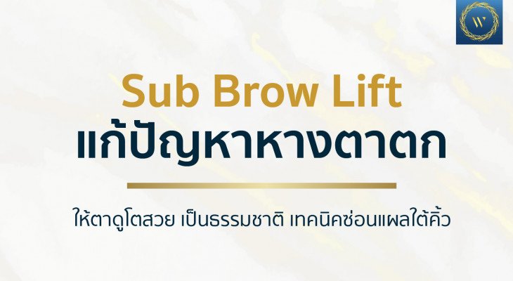 รวมรีวิวก่อนและหลังทำ Sub Brow Lift แก้ปัญหาหนังตาตก